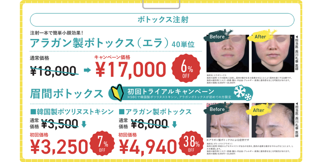 お客様・スタッフから大人気のお手軽シワ改善『ボトックス』