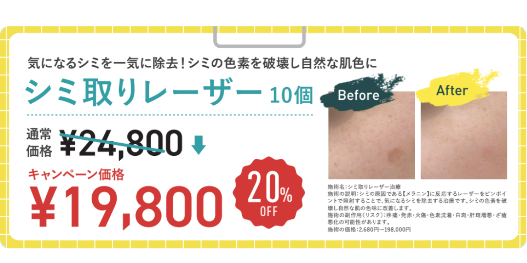 とるなら”今”紫外線の少ない時期にシミのない均一な肌へ『シミ取りレーザー』
