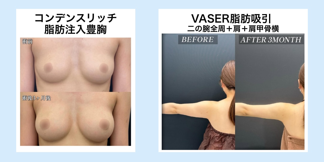 新海院長の症例写真はこちら