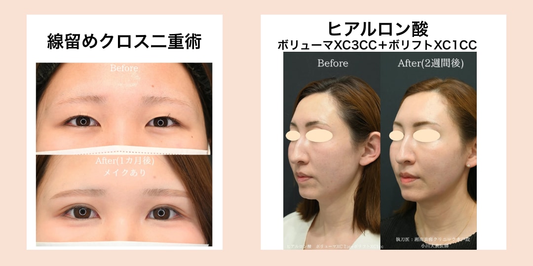 小川医師の症例写真はこちら