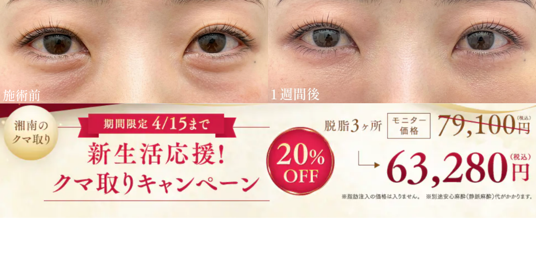 目の下の切らないクマ取り