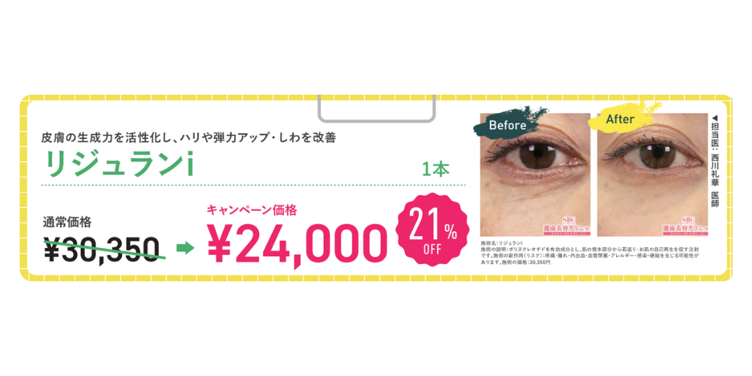 目元のしわ改善・ハリUPなら『リジュランi』