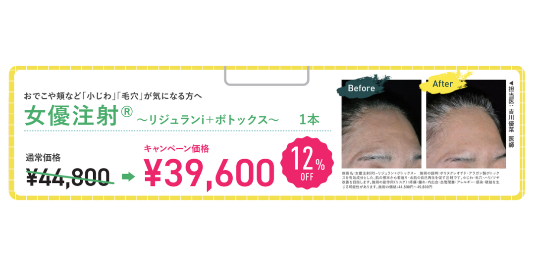 毛穴を小さくしたい、なくしたい、透明肌やシワのない肌を目指すなら『女優注射』