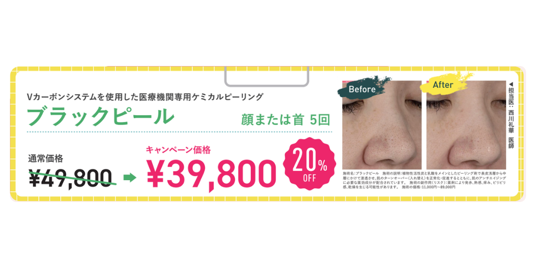 毛穴の黒ずみやニキビの改善なら『ブラックピール』