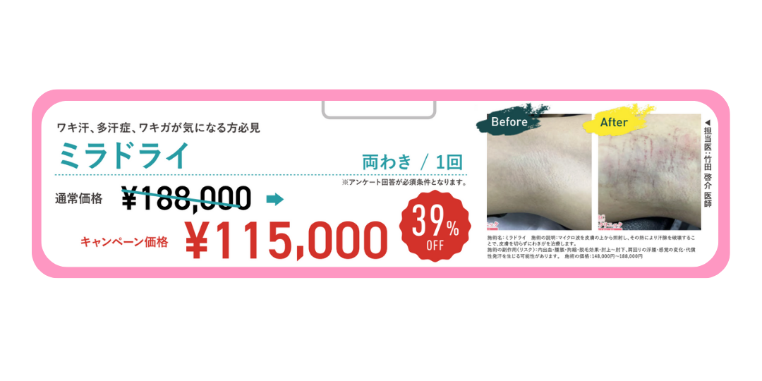 冬も気になる脇汗治療には『ミラドライ』