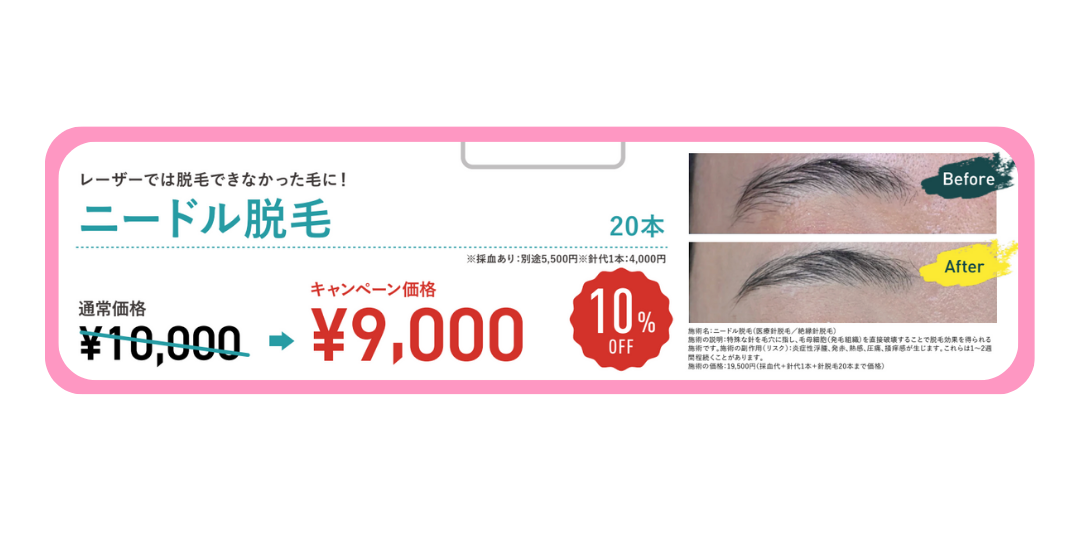 医療脱毛では打てなかった部分にアプローチする『ニードル脱毛』