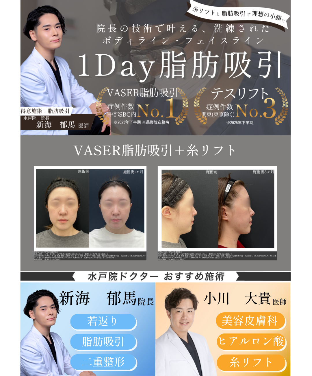 新海医師の得意施術は脂肪吸引とクマ取りです。3月に向けての集客で二重施術の症例写真を掲載してます。