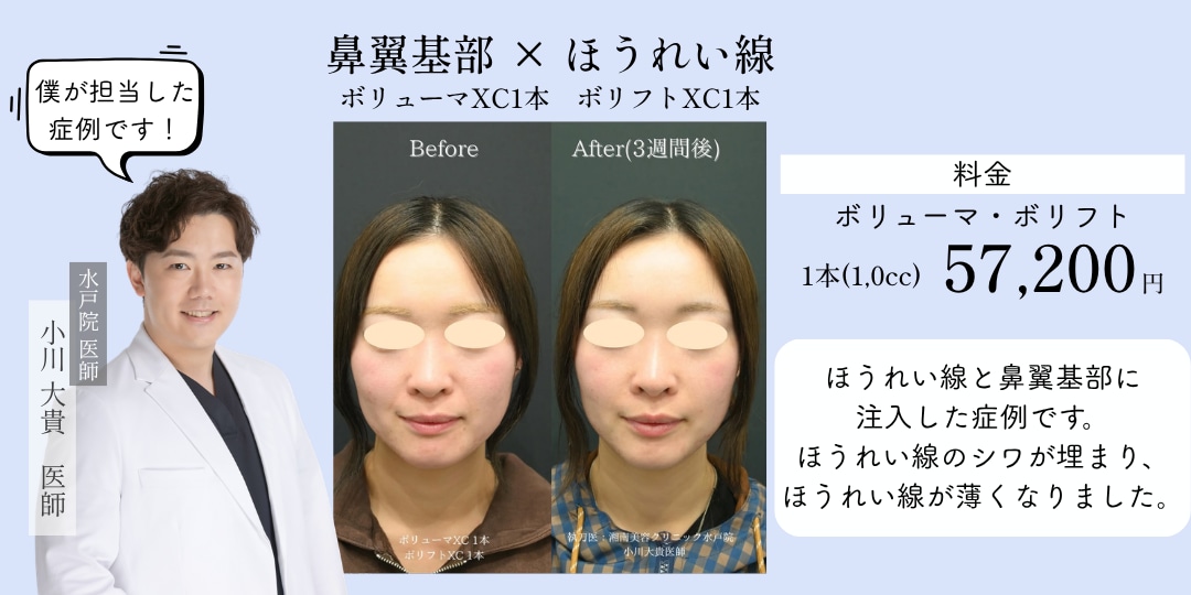 〜若返りヒアルロン酸〜