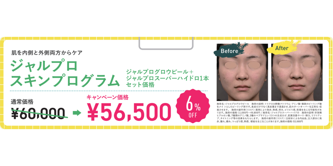 エイジングケアスペシャルセットがお得な価格に