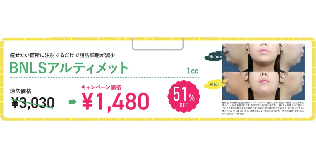 BNLSアルティメット