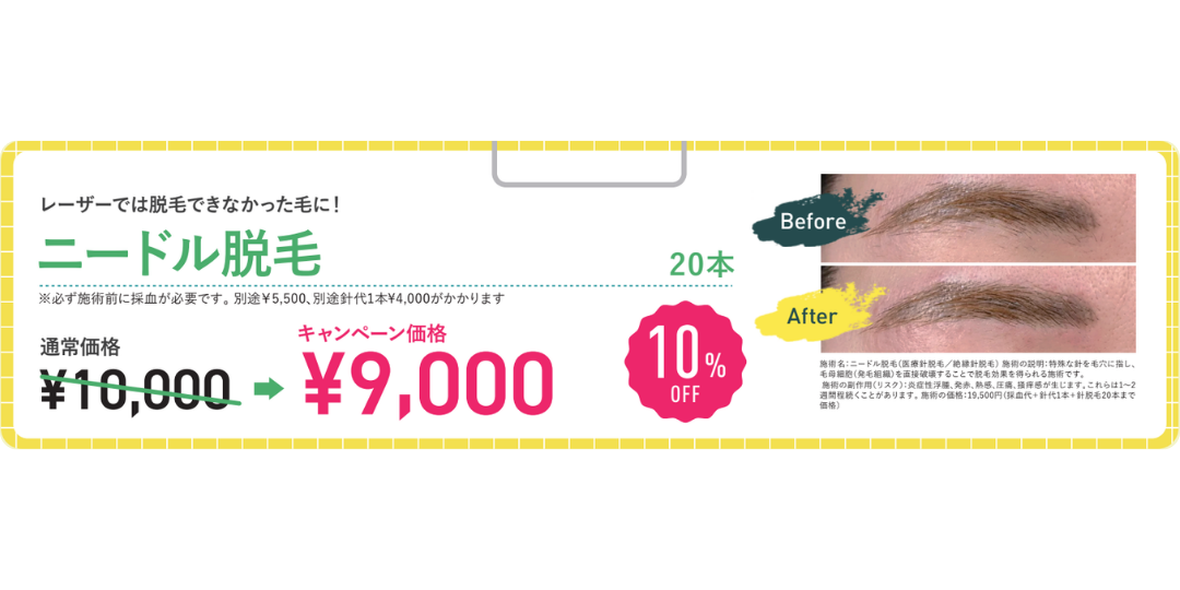 ニードル脱毛