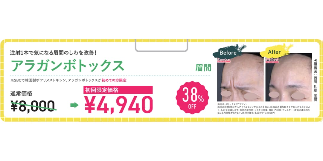 眉間ボトックス（初回限定価格）
