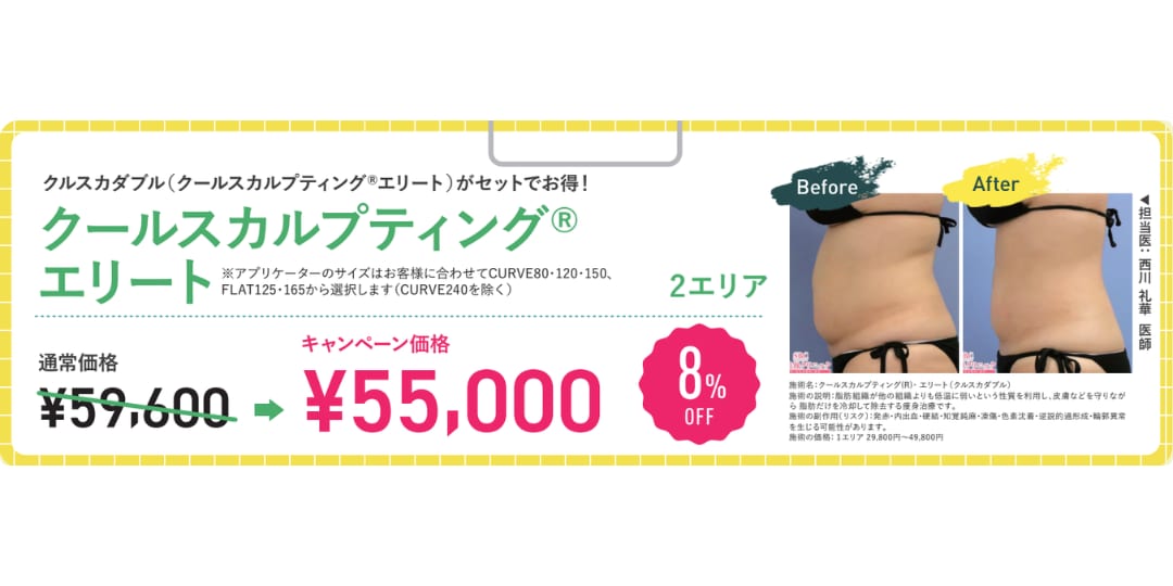 クールスカルプティング