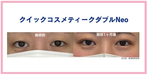 症例② 