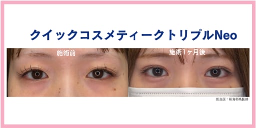 症例① 