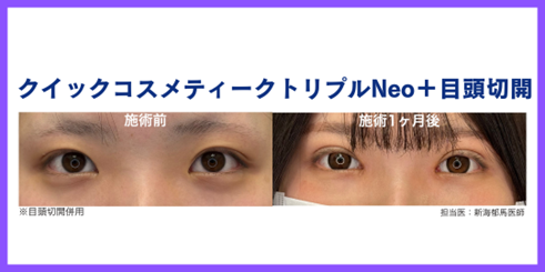 症例① 