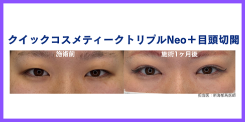 症例② 