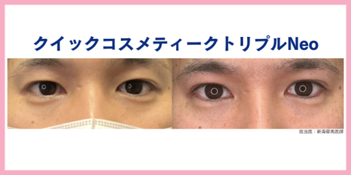 症例③ 