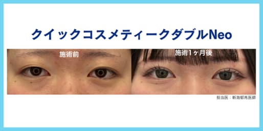 2位 クイックコスメティーク・ダブルNeo 