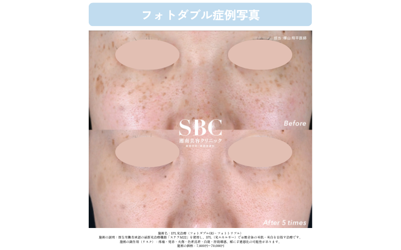 ひとつずつは小さいのに、集まるとトーンが下がる