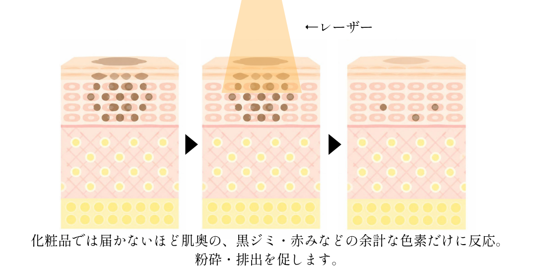 狙ったところだけに届く仕組み
