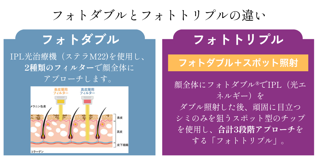 一目で分かる比較表｜2つのメニューの違い