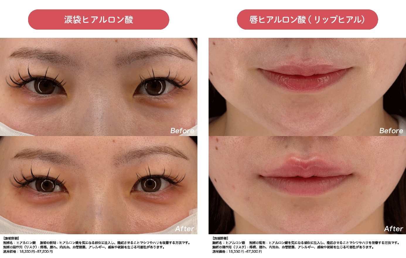 夕方には消えてる涙袋と、食事のたびに描き直すリップライン
