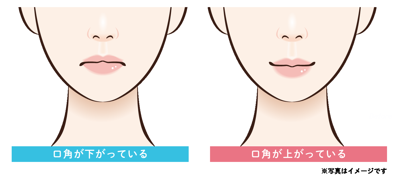 口角ボトックス｜真顔で不機嫌に見えてしまう方に
