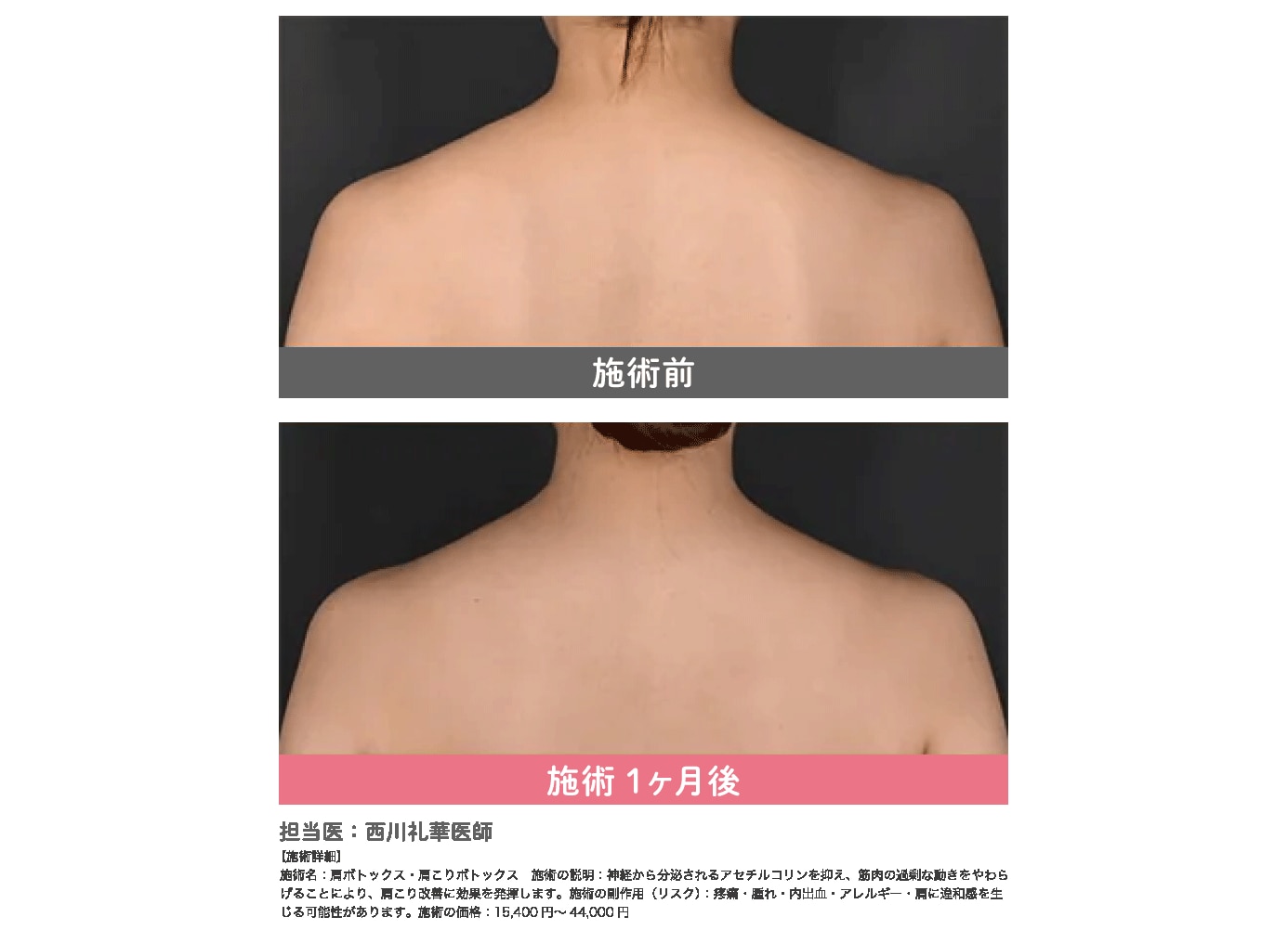 肩のラインで、上半身の見え方が全部変わる