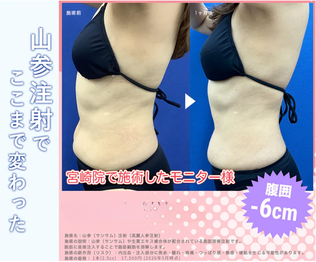 山参注射
