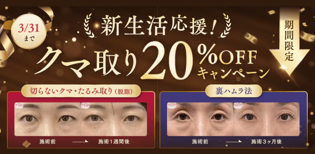 新生活応援！クマ取り20％OFFキャンペーン🎉