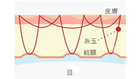 施術の解説