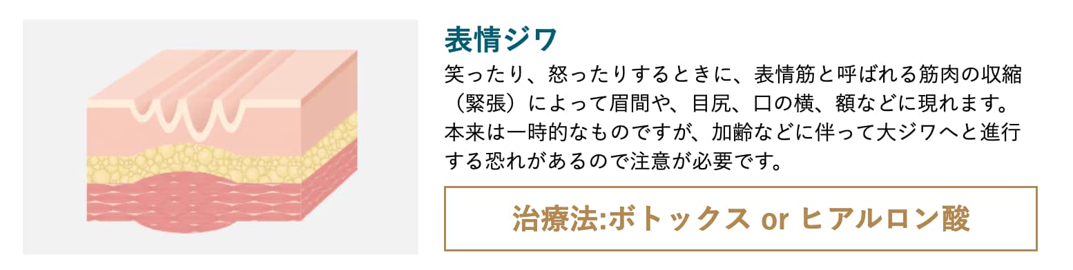 表情ジワとは