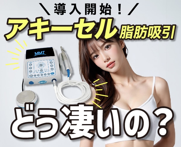 導入開始！アキーセル脂肪吸引ってどう凄いの？