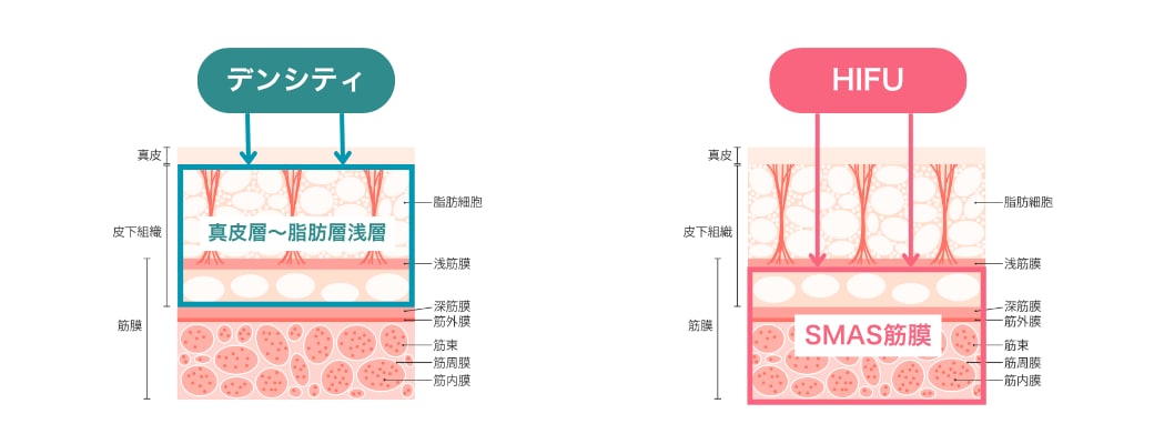 “効かせる膜”にも違いあり！