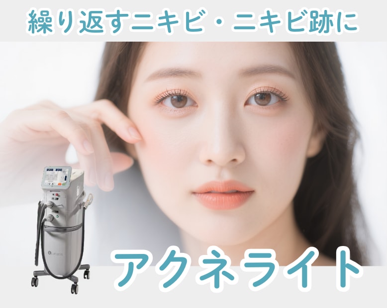 繰り返すニキビ・ニキビ跡にアクネライト。武蔵小杉で肌荒れを治す方法教えます！
