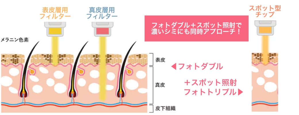 「ダブル」と「トリプル」の違い