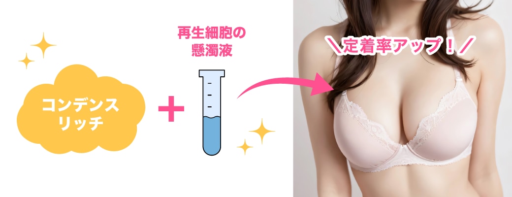 リジェネラは「脂肪を強力に生着させる、高濃度の肥料」