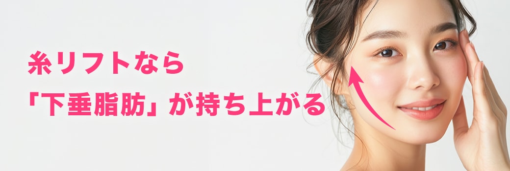 糸リフトの魅力