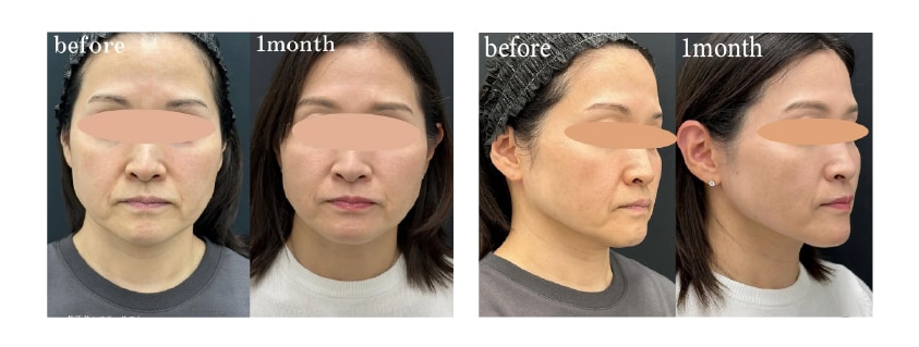 宮嶋佑有医師の症例写真