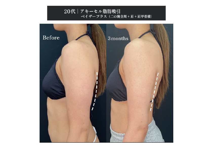 藤井里奈医師の症例写真2