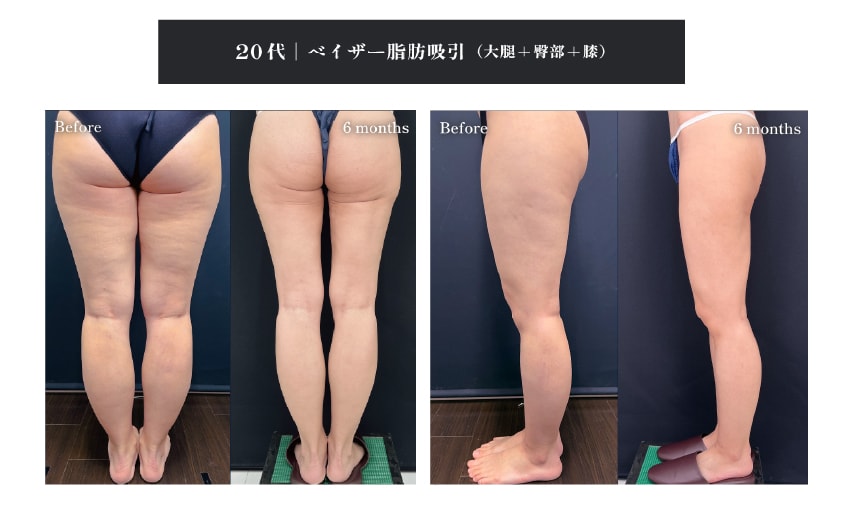 藤井里奈医師の症例写真1