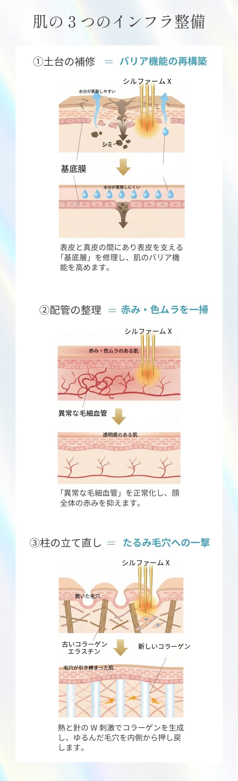 3つのインフラ整備