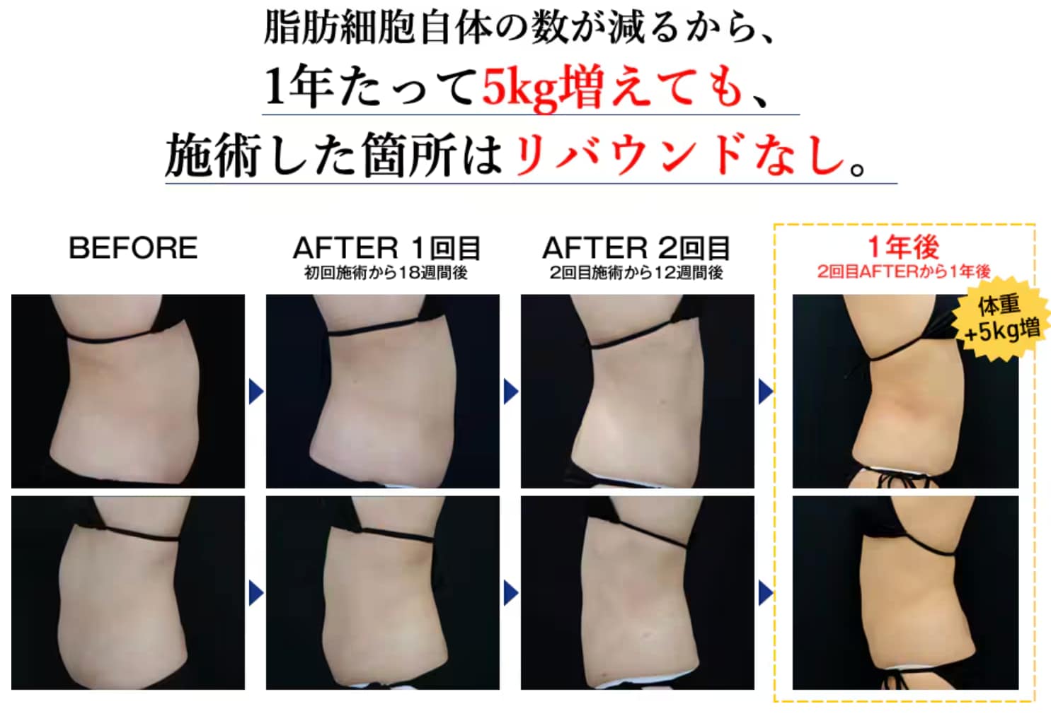食事制限や運動によるダイエットでリバウンドした方へ