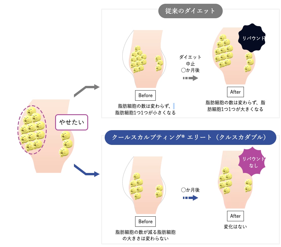 脂肪冷却でリバウンドしにくい仕組み