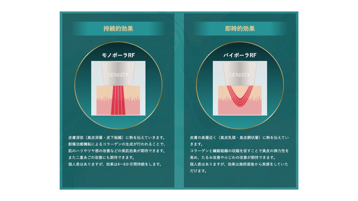 【Step3】デンシティ（高周波RF）で皮膚表面の即時タイトニングと肌質改善