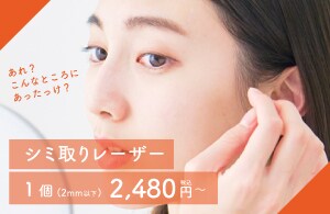 いつの間にか増えたシミは早めの治療が肝心！