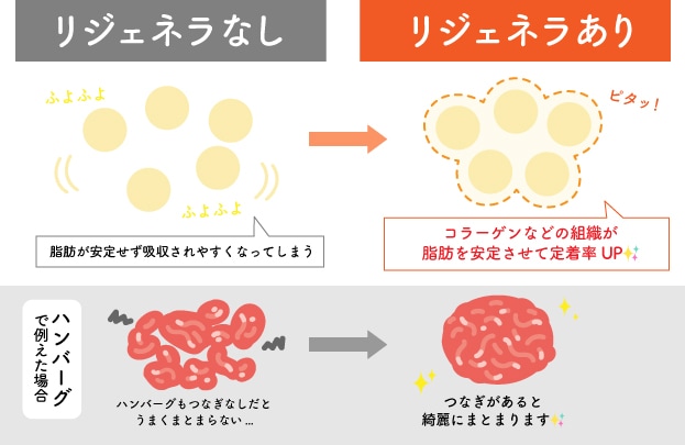 「リジェネラ」とは