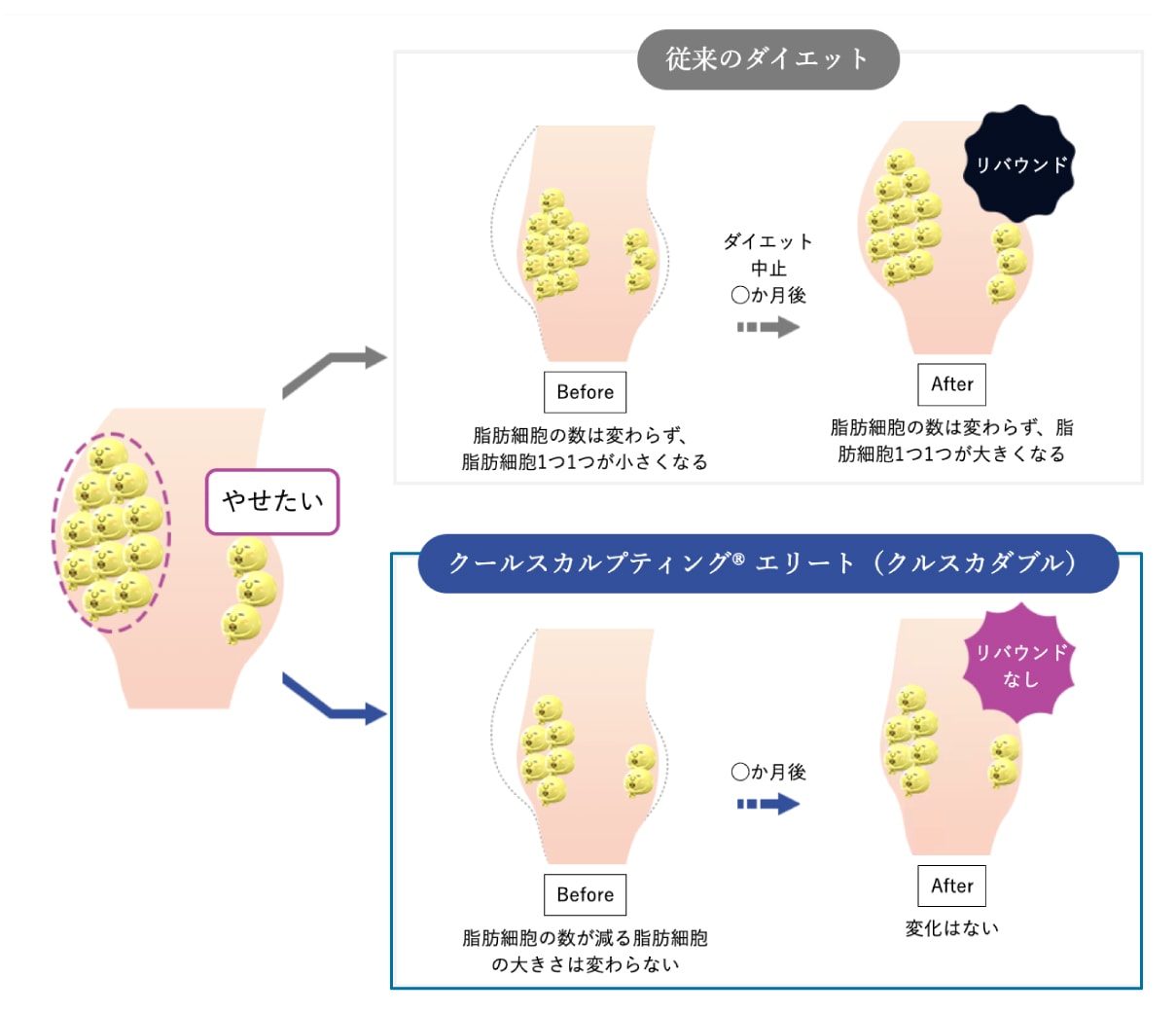 脂肪細胞を減らすからリバウンドしにくい