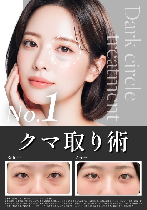 【クマ取り】全術式対応ドクターによる、高クオリティークマ取り術